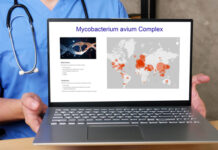 BACES Score May Help Predict Clinical Outcomes and Clinical/Radiological Response in MAC-LD