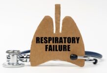 ROX Index Predicts High-Flow Nasal Cannula Outcomes in Acute Hypoxic Respiratory Failure