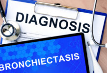 Analyses Confirm Brensocatib Effectiveness in All Bronchiectasis Subgroups